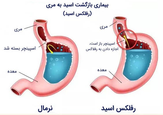 دلایلی غیر از بیماری قلبی که در سمت چپ قفسه سینه درد ایجاد می‌کنند